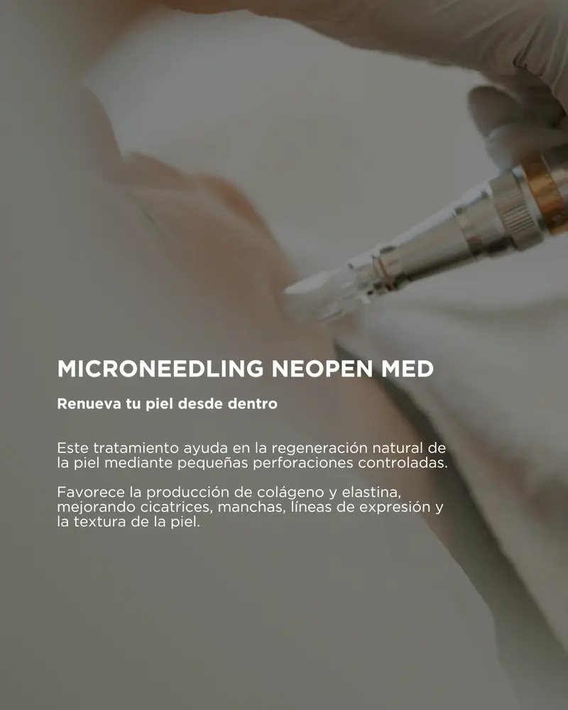Microneedling NeopenMED